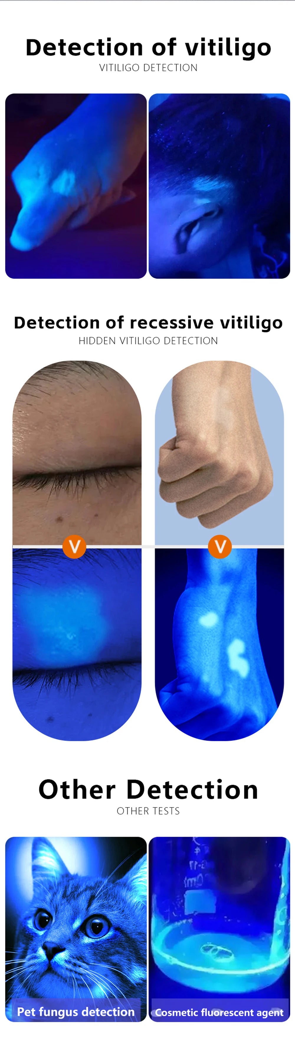 Wood’s Lamp UV Skin Analyzer for Facial Testing