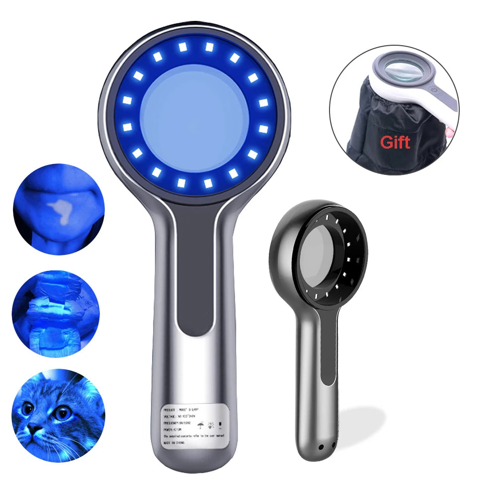 Wood’s Lamp UV Skin Analyzer for Facial Testing
