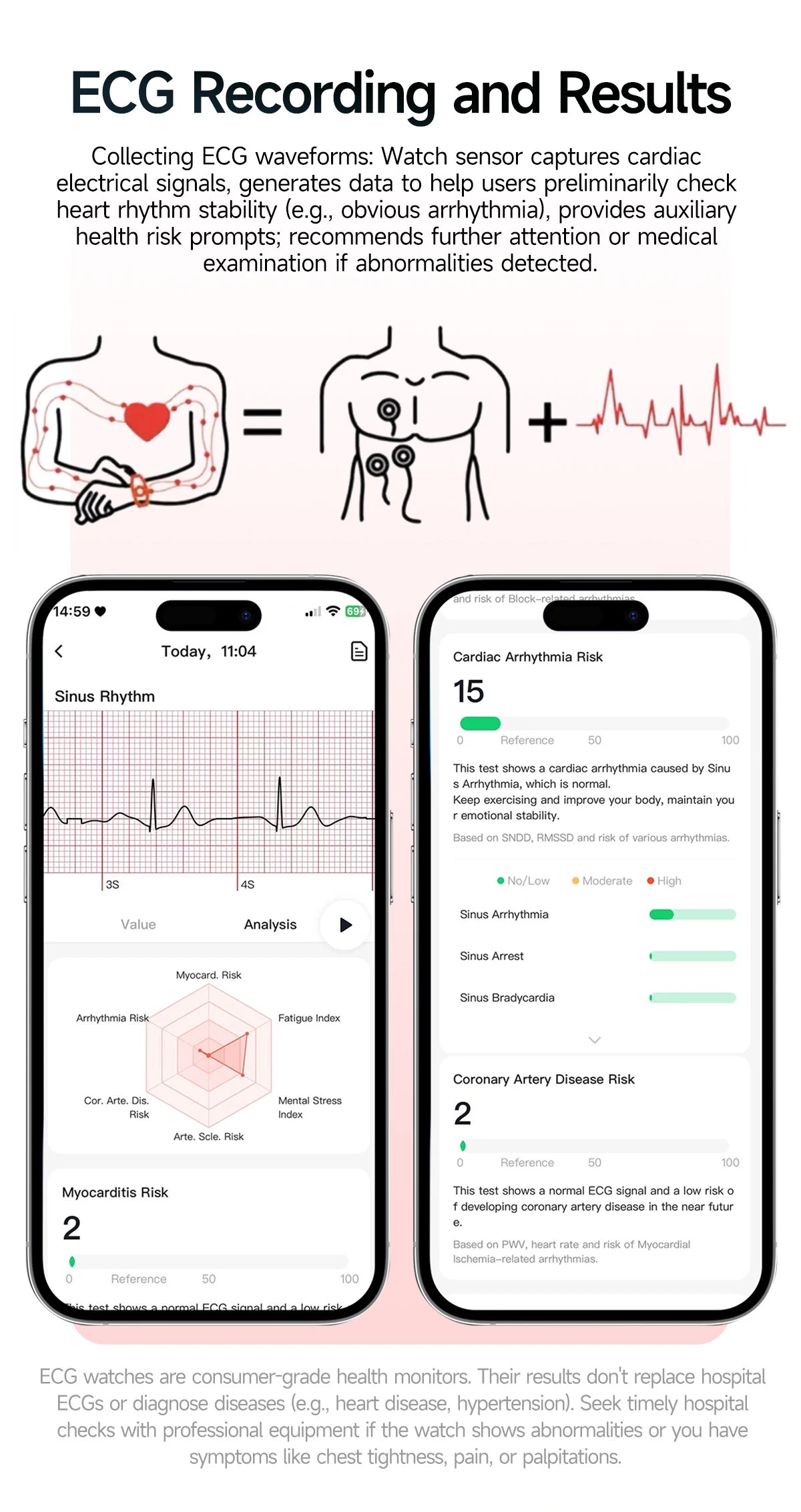 Men’s ECG Health Monitoring Smartwatch with Bluetooth Call