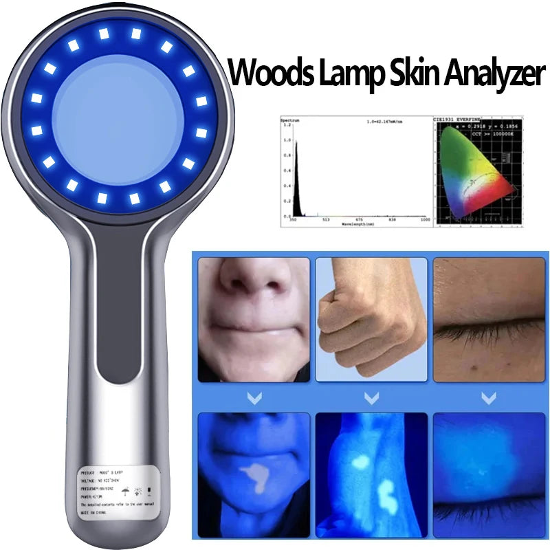 Wood’s Lamp UV Skin Analyzer for Facial Testing