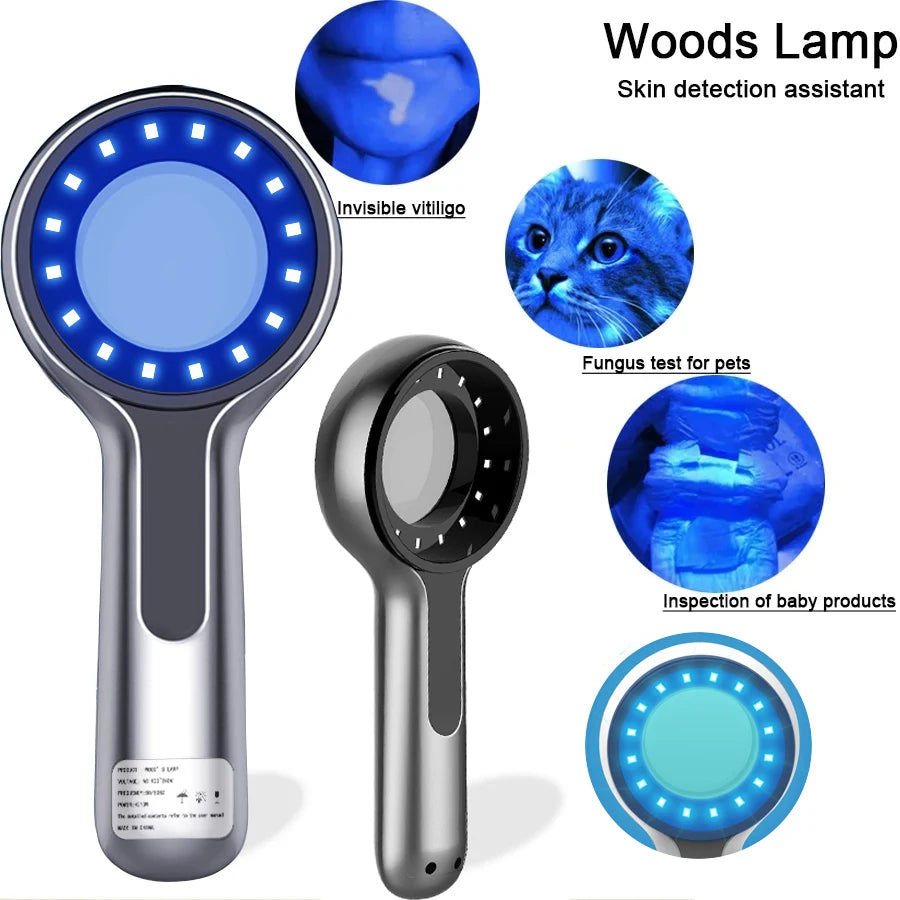 Wood’s Lamp UV Skin Analyzer for Facial Testing